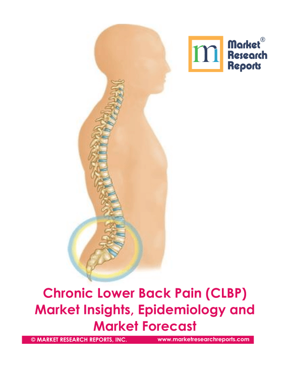 Chronic Lower Back Pain (CLBP) Market Insights, Epidemiology and Market Forecast