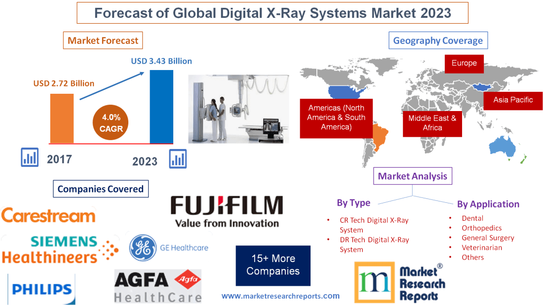 Forecast of Global Digital X-Ray Systems Market 2023