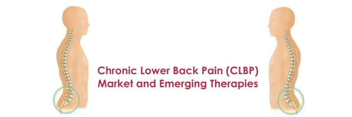 Chronic Lower Back Pain (CLBP) Market and Emerging Therapies