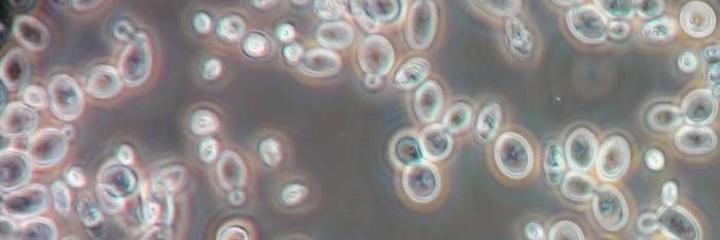 World Yeast Market to Grow 4.4% annually from 2015 to 2019