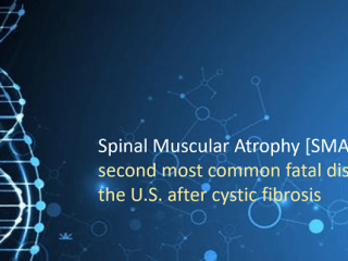 Spinal Muscular Atrophy (SMA) - Market Insights, Epidemiology and Market