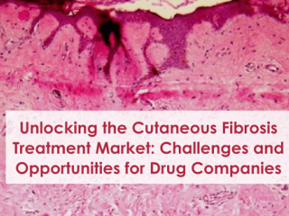 Unlocking the Cutaneous Fibrosis Treatment Market Challenges and Opportunities for Drug Companies