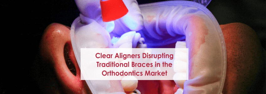 Clear Aligners Disrupting Traditional Braces in the Orthodontics Market